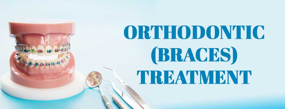 Orthodontic-Braces-Treatment-singhdentalhospital.com